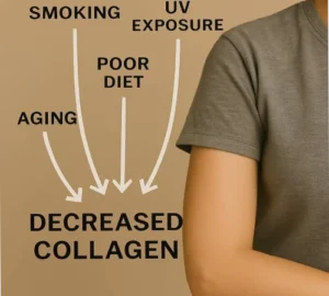عوامل موثر در کاهش کلاژن بدن